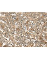 ARCN1 Polyclonal Antibody (E-AB-19716) elabscience