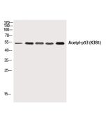 Acetyl-P53 (Lys381) Polyclonal Antibody (E-AB-20287) elabscience