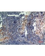 ERK 1 Monoclonal Antibody (E-AB-22247) elabscience