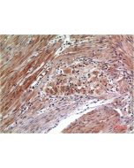 Phospho-ERK 1/2 (Tyr222/205) Monoclonal Antibody (E-AB-51039) elabscience