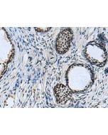 CCAR2 Polyclonal Antibody (E-AB-52105) elabscience
