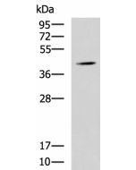 SPI1 Polyclonal Antibody (E-AB-52113) elabscience