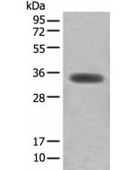 MYOZ2 Polyclonal Antibody (E-AB-52584) elabscience