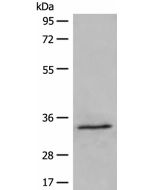 DIMT1 Polyclonal Antibody (E-AB-52600) elabscience