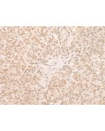 EIF4A3 Polyclonal Antibody (E-AB-52632) elabscience