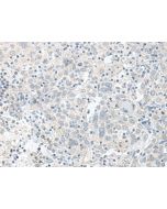 TIMM8A Polyclonal Antibody (E-AB-52670) elabscience