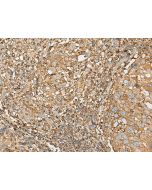 UBE2A Polyclonal Antibody (E-AB-52693) elabscience
