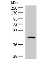 MAGEC2 Polyclonal Antibody (E-AB-52920) elabscience