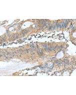 PAFAH1B3 Polyclonal Antibody (E-AB-53102) elabscience