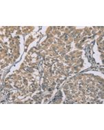 ZBTB2 Polyclonal Antibody (E-AB-53223) elabscience