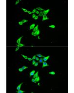 CD55 Polyclonal Antibody (E-AB-60267) elabscience