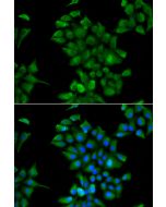 CTNS Polyclonal Antibody (E-AB-61386) elabscience