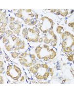 B9D1 Polyclonal Antibody (E-AB-62419) elabscience