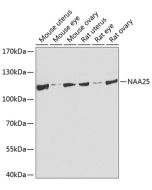 NAA25 Polyclonal Antibody (E-AB-62529) elabscience