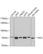 GALC Polyclonal Antibody (E-AB-62750) elabscience