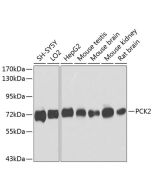 PCK2 Polyclonal Antibody (E-AB-62856) elabscience