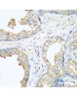 CBL Polyclonal Antibody (E-AB-63260) elabscience