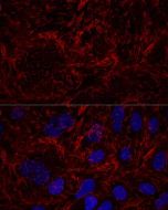 SEPT9 Polyclonal Antibody (E-AB-63893) elabscience