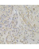 REG3A Polyclonal Antibody (E-AB-64197) elabscience