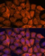 RPAP3 Polyclonal Antibody (E-AB-66471) elabscience