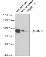 ADAM15 Polyclonal Antibody (E-AB-67909) elabscience