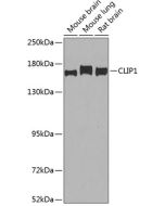 CLIP1 Polyclonal Antibody (E-AB-68408) elabscience