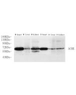 ACHE Polyclonal Antibody (E-AB-70014) elabscience