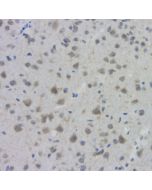 ACHE Polyclonal Antibody (E-AB-70015) elabscience