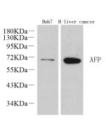 AFP Polyclonal Antibody (E-AB-70145) elabscience