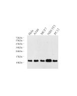 S100A4 Polyclonal Antibody (E-AB-70283) elabscience