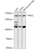 MKL2 Polyclonal Antibody (E-AB-90580) elabscience