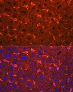 Ceruloplasmin Polyclonal Antibody (E-AB-90643) elabscience