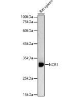 NCR1 Polyclonal Antibody (E-AB-90867) elabscience
