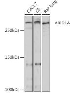 ARID1A Polyclonal Antibody (E-AB-92107) elabscience