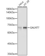 GALNT7 Polyclonal Antibody (E-AB-92209) elabscience