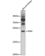 ADM Polyclonal Antibody (E-AB-92899) elabscience