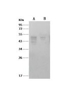 Anti-SARS-CoV Nucleoprotein / NP Monoclonal Antibody (E-AB-V1342) elabscience