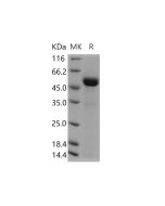 Recombinant Human ART3 Protein (His Tag) (PKSH030605) elabscience