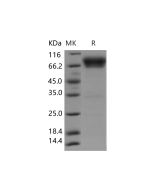 Recombinant Human B7-H4/VTCN1 Protein (Fc Tag) (PKSH031453) elabscience