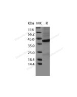 Recombinant Human FRZB/sFRP-3 Protein (His Tag) (PKSH031646) elabscience