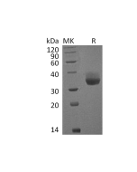 Recombinant Cynomolgus PD-L1/B7-H1/CD274 Protein (His Tag) (PKSQ050024) elabscience