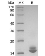 Biotinylated Cynomolgus ITPRIPL1 (C-6His-Avi)(Cat. No.:CY179) novoprotein