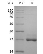 Recombinant Human BAFF (N-6His)(Cat. No.:C00D) novoprotein