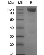 Recombinant Human Siglec-10 (C-mFc)(Cat. No.:C01G) novoprotein