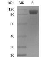 Recombinant Mouse ANG2 (C-Fc)(Cat. No.:C01U) novoprotein