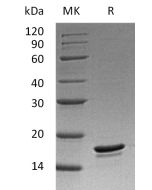 Recombinant Human Bc1-w (C-6His)(Cat. No.:C105) novoprotein