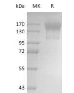 Recombinant Human CD45 (C-6His)(Cat. No.:C11W) novoprotein