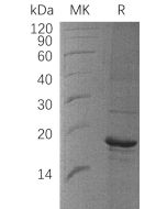Recombinant Human ZBP1 (C-6His)(Cat. No.:C282) novoprotein