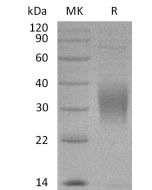 Recombinant Cynomolgus TREM2 (C-6His)(Cat. No.:C15R) novoprotein