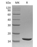 Recombinant Human TNF beta(Cat. No.:C181) novoprotein